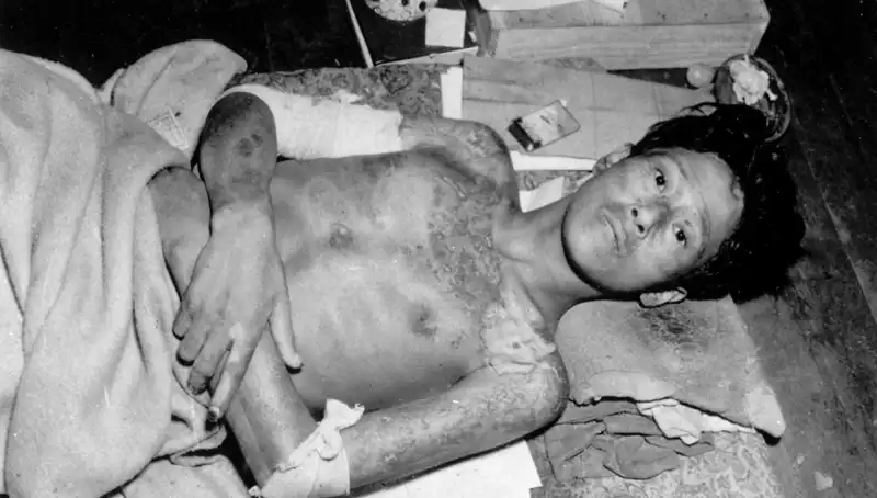 80 Yıl Sonra Nagasaki'den Gelen Acil Çağrı: Nükleer Tehdit Yeniden Kapıda