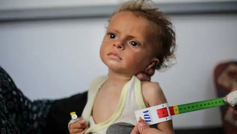 İngiltere, 300 Gazze’li Çocuğa Yeni Bir Gelecek Sunacak