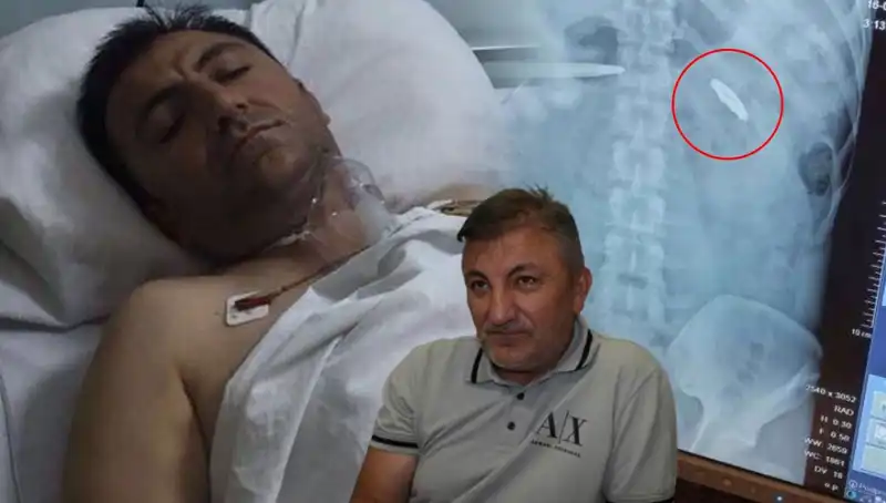 15 Temmuz'dan Sonra Acı Bir Hatıra: Vücudundaki Kurşunla Yaşayanlar